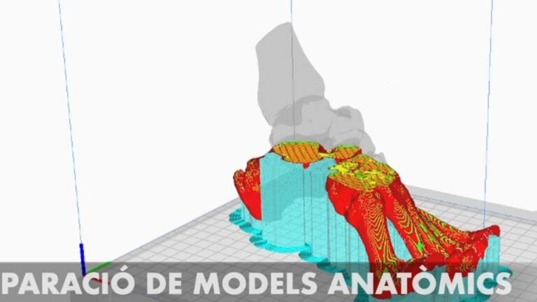 L’HTVC posa en funcionament el Laboratori de Planificació Quirúrgica 3D
